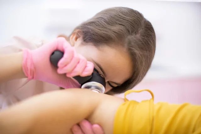 Badanie znamion dermatoskopem